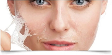 Ciltteki Güneş Lekeleri Belirtileri ve Tedavisi