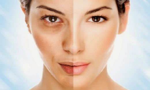 Yüzdeki Güneş Lekeleri İçin Krem Özellikleri ve Faydaları Nelerdir?