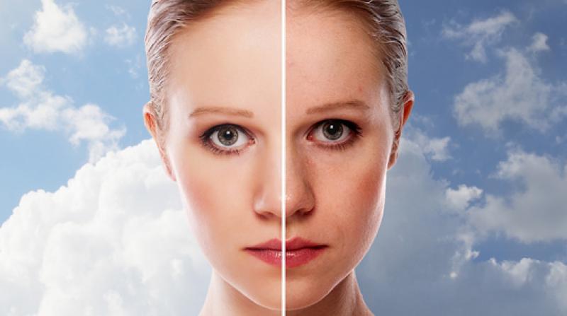 Güneş Lekeleri İçin Krem Kullanımı ve Faydaları Nelerdir?